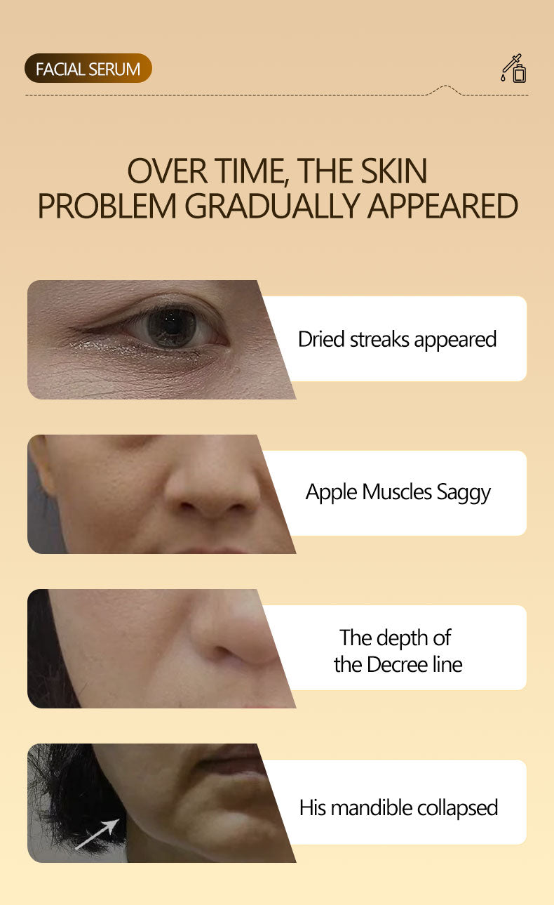 [FDA] [UK MADE] BEAUTY SIGN Anti-Ageing Blemish&Mark Wrinkle Reducing Essence Skincare Comfort-UK Made 30ml with OLGOPEPTIDE-1 & Allergen Free