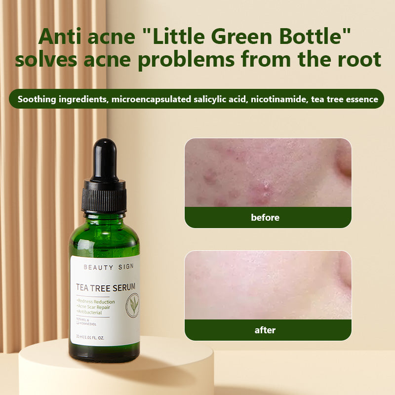 [FDA] [UK MADE] BEAUTY SIGN Anti Ageing Anti Mark & Blemish TEA TREE SERUM 30ml FOR SKIN REPAIR - SKINCARE