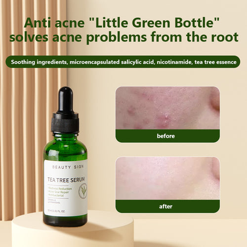 [FDA] [UK MADE] BEAUTY SIGN Anti Ageing Anti Mark & Blemish TEA TREE SERUM 30ml FOR SKIN REPAIR - SKINCARE