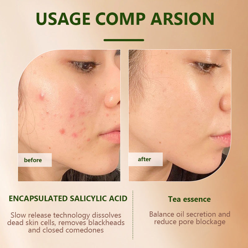 [FDA] [UK MADE] BEAUTY SIGN Anti Ageing Anti Mark & Blemish TEA TREE SERUM 30ml FOR SKIN REPAIR - SKINCARE